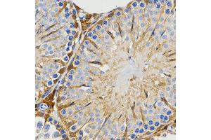 Immunohistochemistry (Paraffin-embedded Sections) (IHC (p)) image for anti-Piwi-Like 4 (PIWIL4) antibody (ABIN2974672)