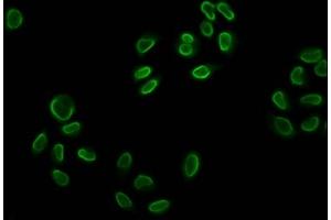 Immunofluorescence staining of Hela cells (treated with 30mM sodium butyrate for 4h) with ABIN7139152 at 1:5, counter-stained with DAPI. (Histone H2B 抗体  (acLys12))
