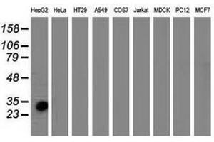 Image no. 2 for anti-Sulfotransferase Family, Cytosolic, 1A, Phenol-Preferring, Member 1 (SULT1A1) antibody (ABIN1501225) (SULT1A1 抗体)