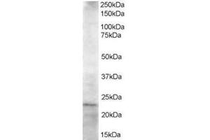 Image no. 1 for anti-Ubiquitin-Conjugating Enzyme E2K (UBE2K) (C-Term) antibody (ABIN374290) (UBE2K 抗体  (C-Term))