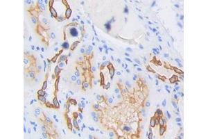 Used in DAB staining on fromalin fixed paraffin- embedded Kidney tissue (TBXAS1 抗体  (AA 357-533))
