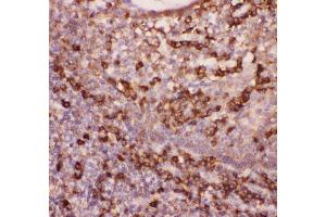Anti-CD11b Picoband antibody ,  IHC(P): Human Tonsil Tissue (CD11b 抗体  (AA 17-382))