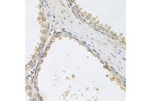 Immunohistochemistry of paraffin-embedded human prostate using POMGNT1 antibody at dilution of 1:100 (x40 lens). (POMGNT1 抗体)