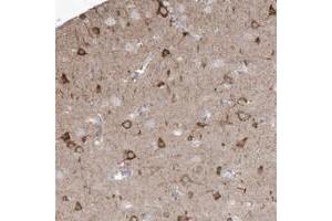 Immunohistochemical staining of human cerebral cortex with GTPBP8 polyclonal antibody  shows strong cytoplasmic positivity in neuronal cells. (GTPBP8 抗体)