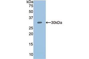 Western blot analysis of recombinant Human PLS3. (Plastin 3 抗体  (AA 379-630))
