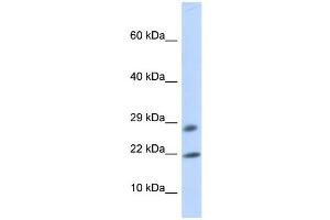 WB Suggested Anti-OCIAD2 Antibody Titration: 0. (OCIAD2 抗体  (Middle Region))