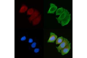 ABIN6263638 and ABIN6272363 staining Hela cells(30 min of UV treatment) by IF/ICC. (Nidogen 抗体  (Internal Region))