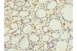 Immunohistochemistry of paraffin-embedded human thyroid tissue using ABIN7152056 at dilution of 1:100 (Ethanolamine Kinase 1 抗体  (AA 90-258))