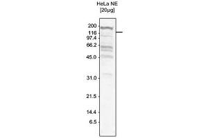Western Blot of anti-SKI3 antibody Western Blot results of Rabbit anti-SKI3 antibody. (TTC37 抗体)