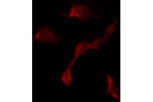 ABIN6267442 staining NIH-3T3 by IF/ICC. (RPS6KB1 抗体  (pThr421))