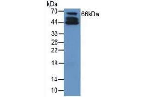 Rabbit Detection antibody from the kit in WB with Positive Control: Human cartilage tissue. (COL10 CLIA Kit)