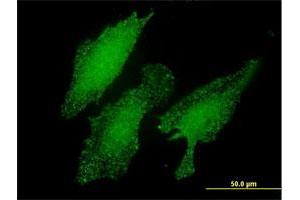 Immunofluorescence of monoclonal antibody to LMO3 on HeLa cell. (LMO3 抗体  (AA 91-146))