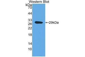 Western Blotting (WB) image for anti-Dopamine beta-Hydroxylase (Dopamine beta-Monooxygenase) (DBH) (AA 335-571) antibody (ABIN1858608) (DBH 抗体  (AA 335-571))