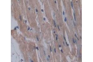 Used in DAB staining on fromalin fixed paraffin- embedded Kidney tissue (ICK 抗体  (AA 1-284))