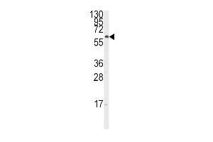 Western blot analysis of anti-CYP17A1 Antibody (Center) (ABIN392362 and ABIN2841999) in K562 cell line lysates (35 μg/lane). (CYP17A1 抗体  (AA 358-388))