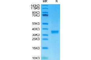 Mouse IgG2C on Tris-Bis PAGE under reduced condition. (IgG2c Protein (AA 97-330))