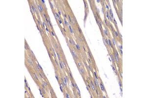 Immunohistochemistry of paraffin-embedded rat heart using FXN antibody. (Frataxin 抗体)