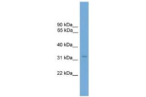 WB Suggested Anti-TCEA2 Antibody Titration: 0. (TCEA2 抗体  (N-Term))
