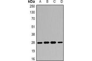 Western blot analysis of 14-3-3 beta expression in SW480 (A), HepG2 (B), mouse liver (C), mouse kidney (D) whole cell lysates. (YWHAB 抗体)