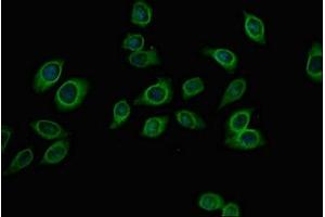 Immunofluorescent analysis of A549 cells using ABIN7144954 at dilution of 1:100 and Alexa Fluor 488-congugated AffiniPure Goat Anti-Rabbit IgG(H+L) (PFKM 抗体  (AA 166-334))