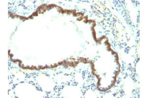 Formalin-fixed, paraffin-embedded Rat Lung stained with Ep-CAM Monoclonal Antibody (Epcam/1158). (EpCAM 抗体)