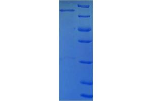 SDS-PAGE (SDS) image for Lymphocyte Cytosolic Protein 1 (LCP1) (AA 2-627) protein (His-SUMO Tag) (ABIN5709841) (LCP1 Protein (AA 2-627) (His-SUMO Tag))