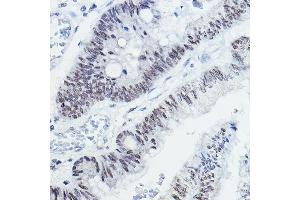 Immunohistochemistry (IHC) image for anti-Nuclear Receptor Co-Repressor 1 (NCOR1) (AA 1-200) antibody (ABIN6144420)