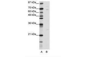 Image no. 2 for anti-Kelch-Like 13 (KLHL13) (N-Term) antibody (ABIN6736185) (KLHL13 抗体  (N-Term))