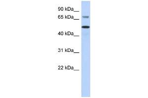 WB Suggested Anti-AKT2 Antibody Titration:  0. (AKT2 抗体  (Middle Region))