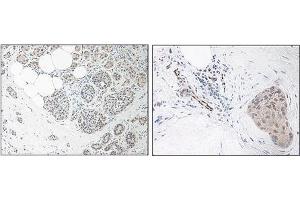 Immunohistochemistry (Paraffin-embedded Sections) (IHC (p)) image for anti-Interleukin 33 (IL33) antibody (ABIN1449499)