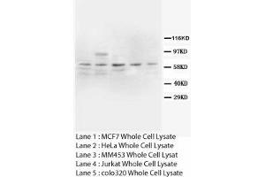 Image no. 2 for anti-Prostaglandin-Endoperoxide Synthase 2 (Prostaglandin G/H Synthase and Cyclooxygenase) (PTGS2) (N-Term) antibody (ABIN1495055)