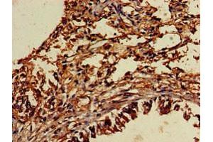 Immunohistochemistry of paraffin-embedded human lung tissue using ABIN7174052 at dilution of 1:100 (TYRO3 抗体  (AA 728-873))