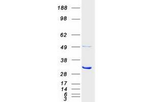 Validation with Western Blot