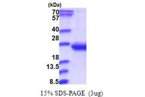 SDS-PAGE (SDS) image for RWD Domain Containing 4 (RWDD4) (AA 1-188) protein (His tag) (ABIN5853747)