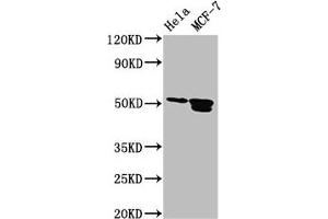 Western Blot Positive WB detected in: Hela whole cell lysate, MCF-7 whole cell lysate All lanes: TFAP2B antibody at 3.