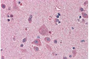 Human Brain, Cortex: Formalin-Fixed, Paraffin-Embedded (FFPE) (NDN 抗体  (AA 222-322))