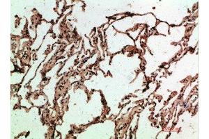 Immunohistochemical analysis of paraffin-embedded human-lung, antibody was diluted at 1:200 (ADI1 抗体  (AA 71-120))