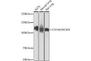 Western blot analysis of extracts of various cell lines, using CD146/MCAM Rabbit mAb (ABIN7268460) at 1:1000 dilution. (MCAM 抗体)