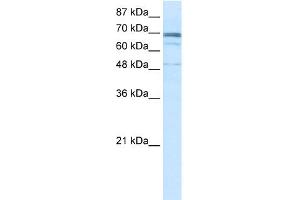 WB Suggested Anti-ZNF614 Antibody Titration:  0. (ZNF614 抗体  (N-Term))