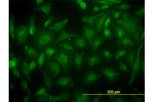 Immunofluorescence of monoclonal antibody to CKB on HeLa cell. (CKB 抗体  (AA 1-381))