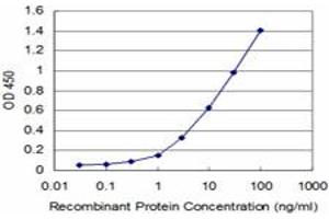 Detection limit for recombinant GST tagged CARF is approximately 1ng/ml as a capture antibody. (CDKN2AIP 抗体  (AA 1-579))