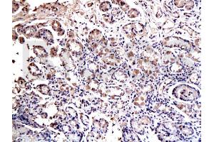 Formalin-fixed and paraffin embedded rat esophagus labeled with Anti-SOX2 Polyclonal Antibody, Unconjugated (ABIN669621) at 1:200 followed by conjugation to the secondary antibody and DAB staining (SOX2 抗体  (AA 227-317))