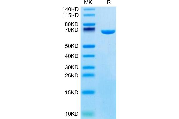 Albumin Protein (ALB) (AA 25-608) (His tag)