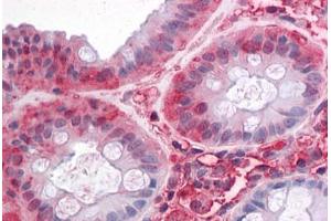 Human Colon: Formalin-Fixed, Paraffin-Embedded (FFPE) (SLC1A5 抗体  (Internal Region))