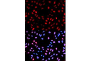 Immunofluorescence analysis of U2OS cells using Phospho-RAF1-S621 antibody (ABIN5969931). (RAF1 抗体  (pSer621))