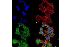 Immunocytochemistry/Immunofluorescence analysis using Mouse Anti-GFAP Monoclonal Antibody, Clone S206A-8 . (GFAP 抗体  (AA 411-422) (Atto 594))