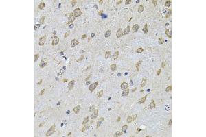 Immunohistochemistry of paraffin-embedded mouse brain using NFU1 Antibody (ABIN2564134) at dilution of 1:100 (40x lens). (NFU1 抗体)