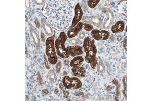 Immunohistochemical staining of human kidney shows strong cytoplasmic and luminal positivity in tubular cells. (PDZK1 抗体)