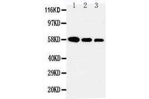 Anti-AHSG antibody, Western blotting Lane 1: Recombinant Human Fetuin A Protein 10ng Lane 2: Recombinant Human Fetuin A Protein 5ng Lane 3: Recombinant Human Fetuin A Protein 2. (Fetuin A 抗体  (N-Term))