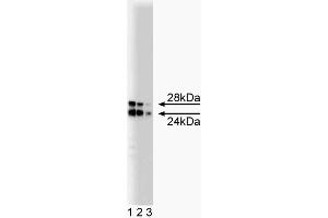 Western Blotting (WB) image for anti-Catechol-O-Methyltransferase (COMT) (AA 26-141) antibody (ABIN968704) (COMT 抗体  (AA 26-141))